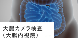 大腸カメラ検査（大腸内視鏡）